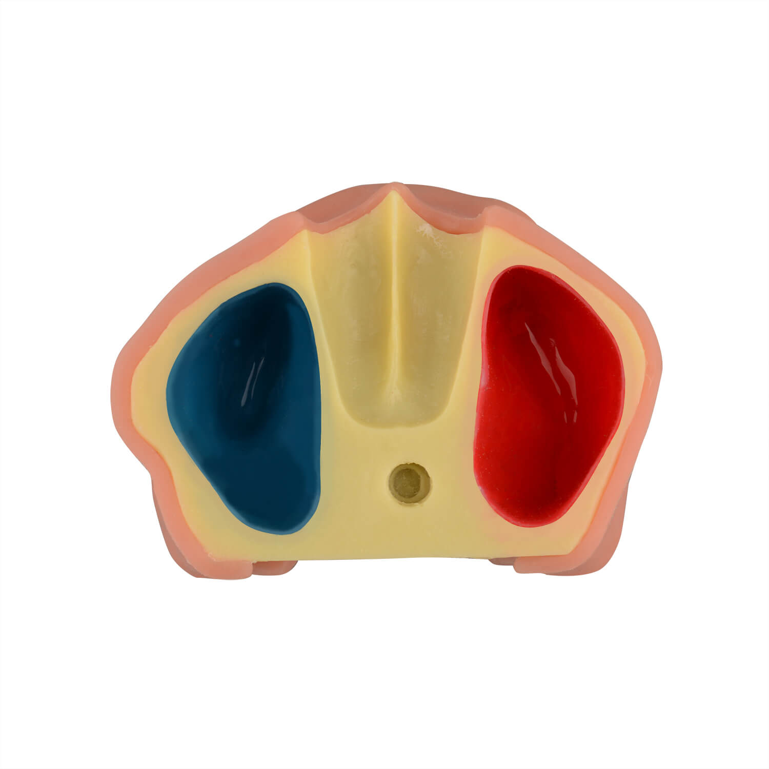 Maxillary Sinus Lift & Implant Practice Model - Type A