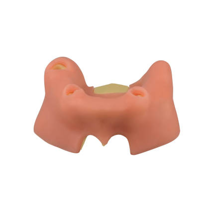 Maxillary Sinus Lift & Implant Practice Model - Type A