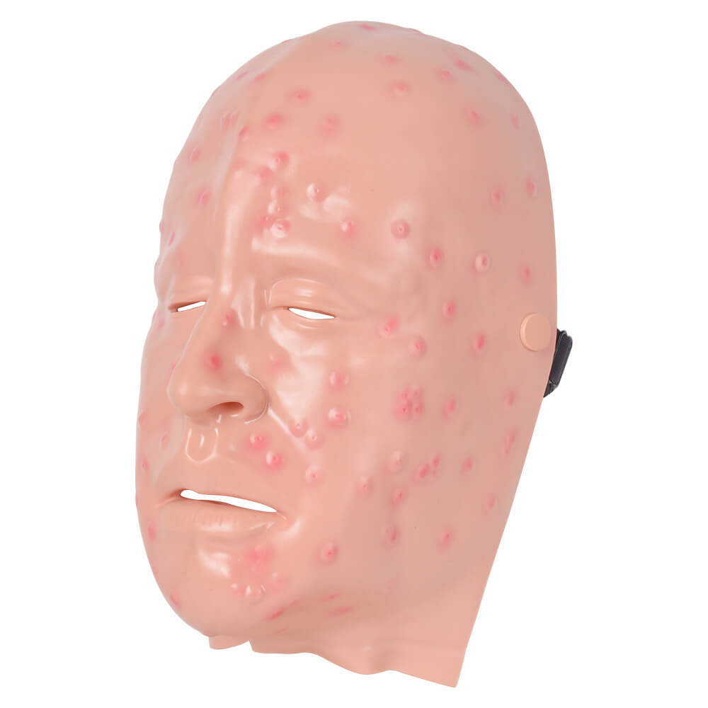 Mild Smallpox Simulation Wound Training Mask
