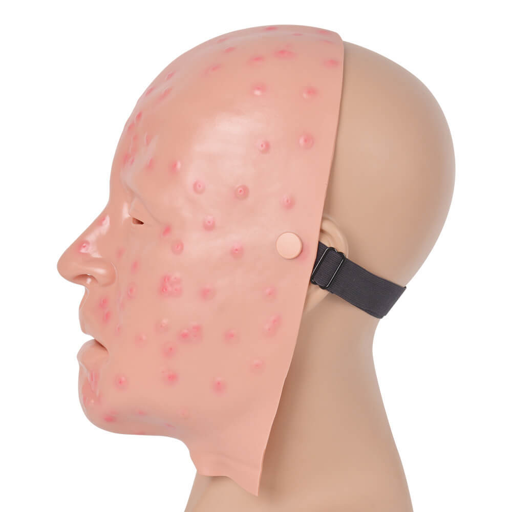 
Mild Smallpox Facial Simulation Wound Training Mask