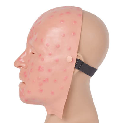 
Mild Smallpox Facial Simulation Wound Training Mask