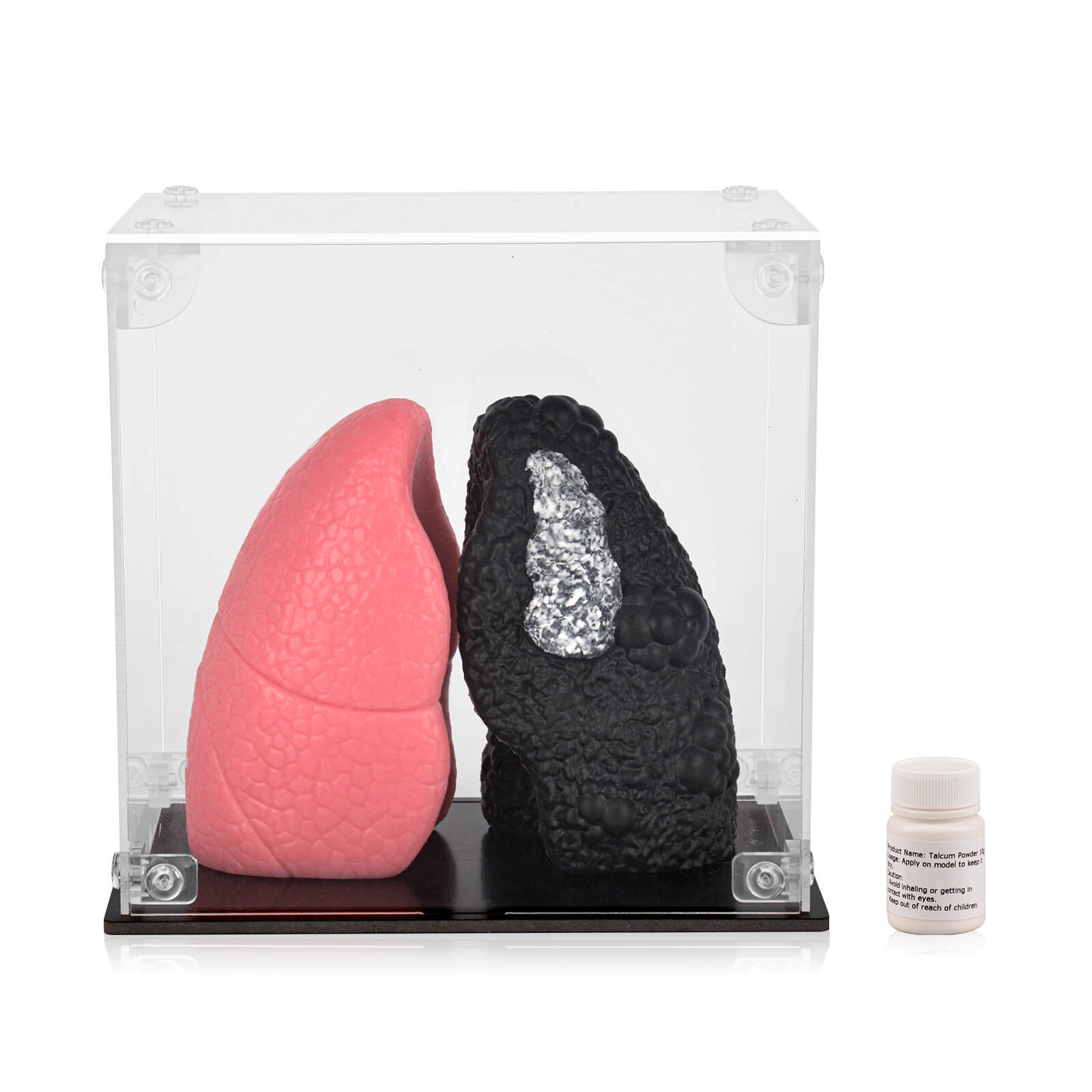 Healthy Lung vs. Smokers Lung Model Set, Mini Size