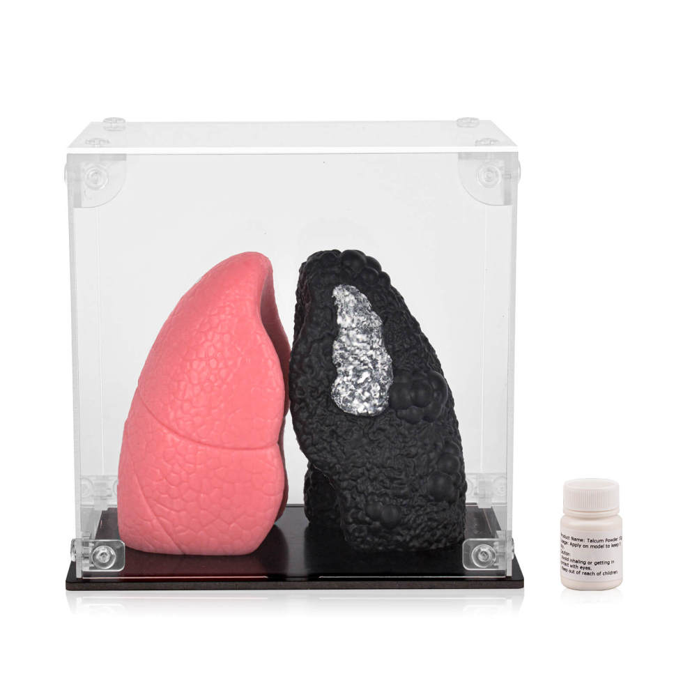 Ultrassist Healthy Lung vs. Smokers Lung Model Set