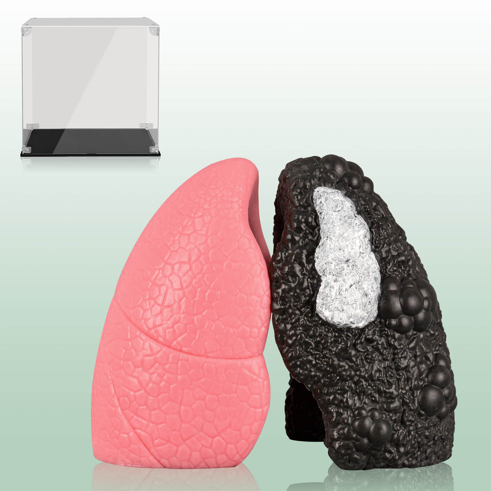 Ultrassist Healthy Lung vs. Smokers Lung Model Set