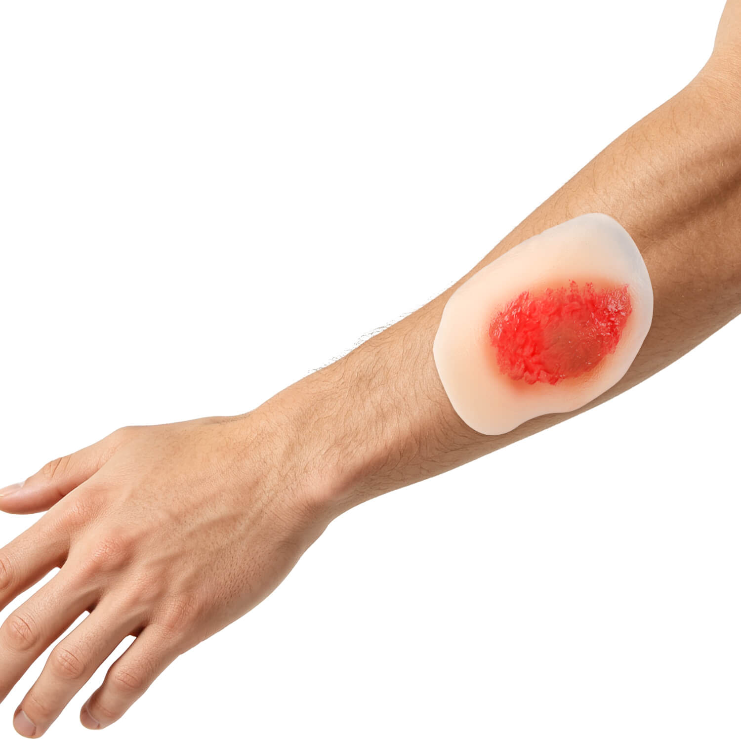 Sticky Moist Wound Healing Stages Teaching Model (Set of 4)