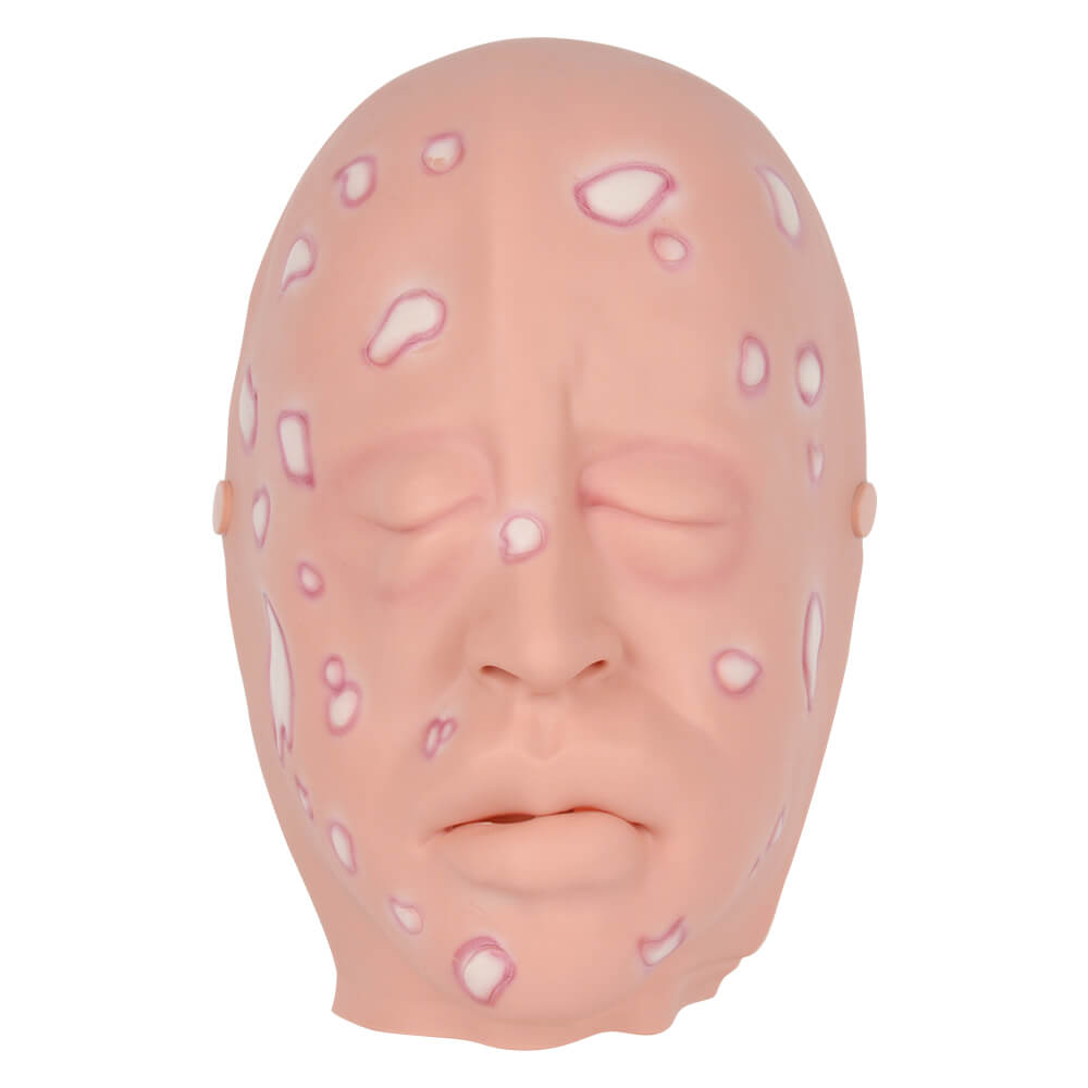 Full-Face Wearable Mustard Gas Facial Injury Model