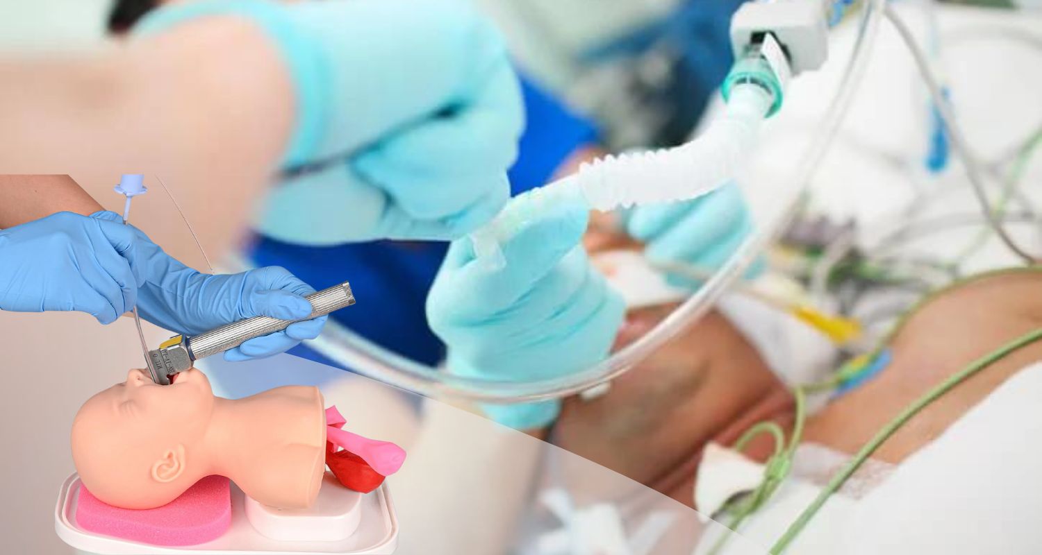 Importance of Neonatal Intubation Technique