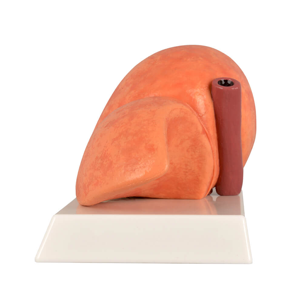 Non-Alcoholic Fatty Liver Disease (NAFLD) Model with Gall Bladder