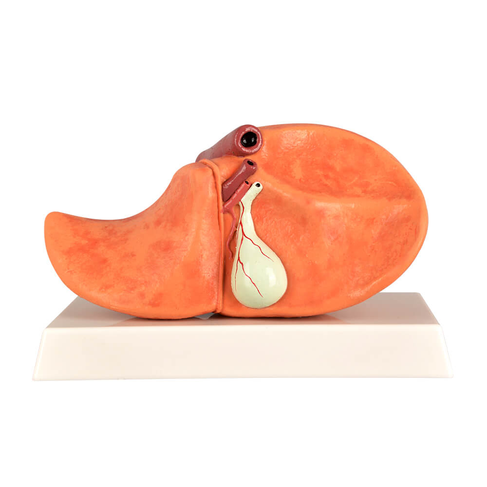 Non-Alcoholic Fatty Liver Disease (NAFLD) Model with Gall Bladder