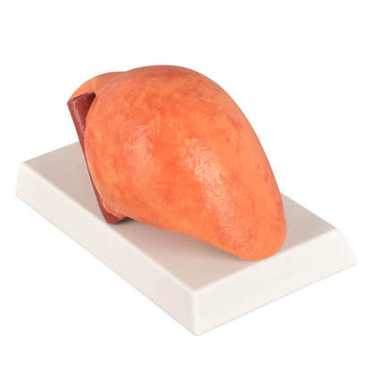 Non-Alcoholic Fatty Liver Disease (NAFLD) Model with Gall Bladder