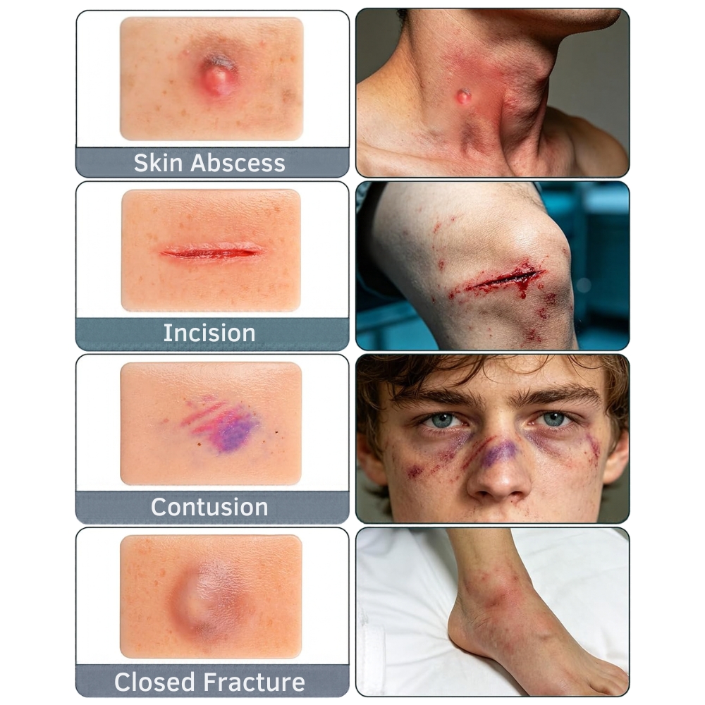 Nursing Wound Simulation Kit (Set of 10)