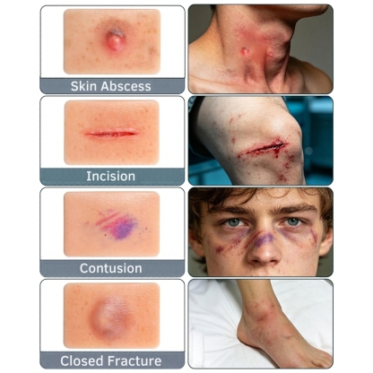 Nursing Wound Simulation Kit (Set of 10)