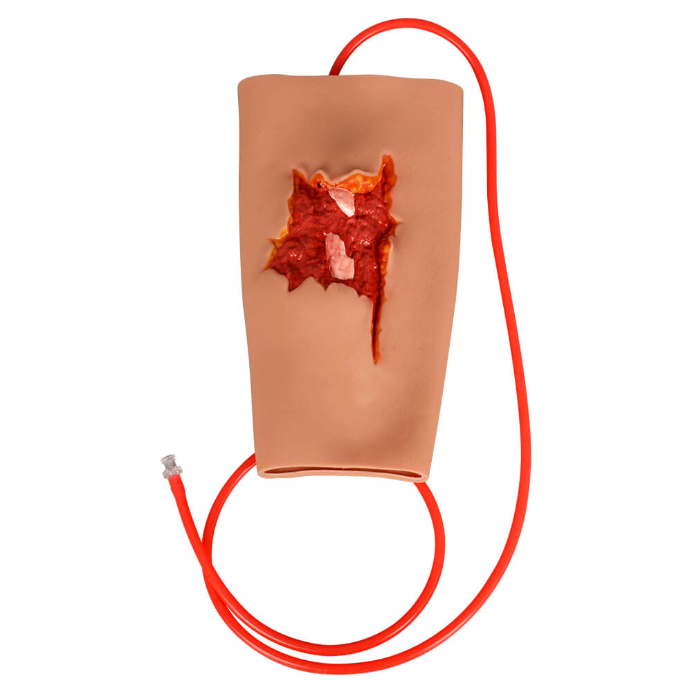 Open Fracture Wound Sleeve for Hemostasis & Fracture Immobilization Practice