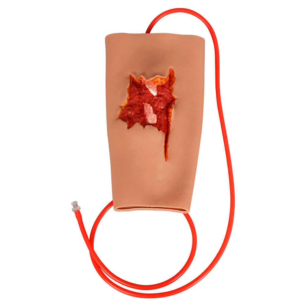 Open Fracture Wound Sleeve for Hemostasis & Fracture Immobilization Practice