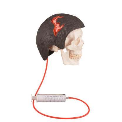 Wearable Open Scalp Wound Moulage with Bleeding Simulation