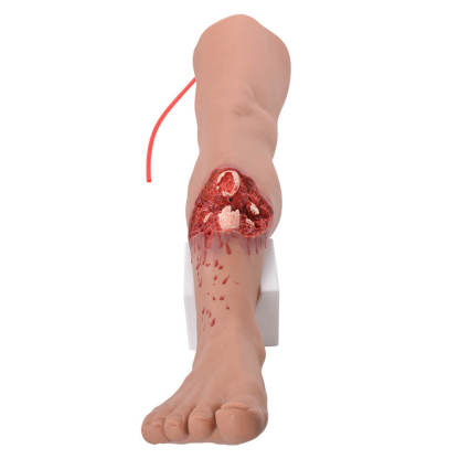 Open Tibial Fracture Leg Wound Simulator