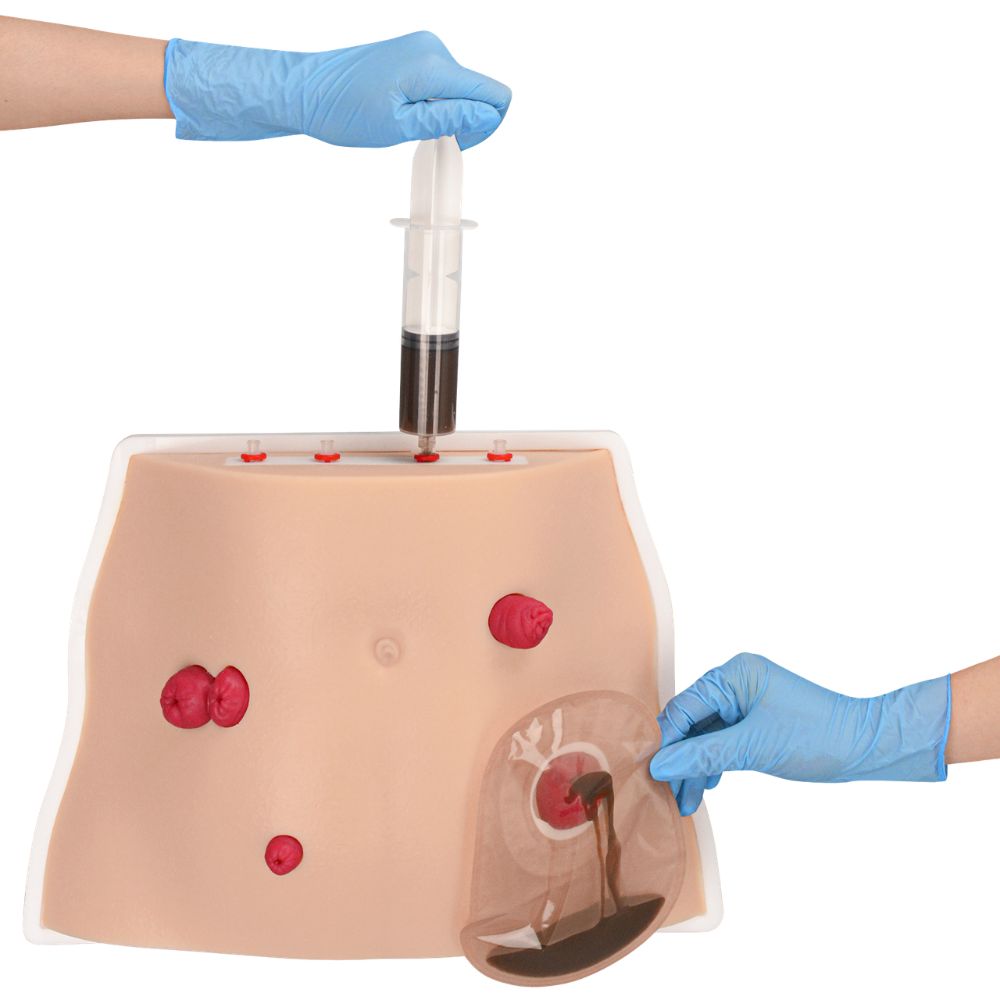 Tabletop Ostomy Care Simulator with 4 Stoma Types