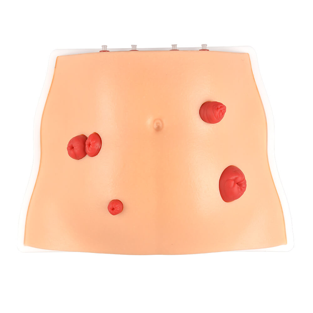 Ostomy Care Simulator with 4 Stoma Types & Display Bracket