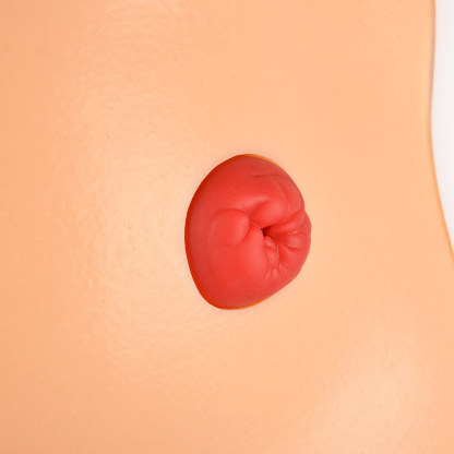 Ostomy Care Simulator with 4 Stoma Types & Display Bracket