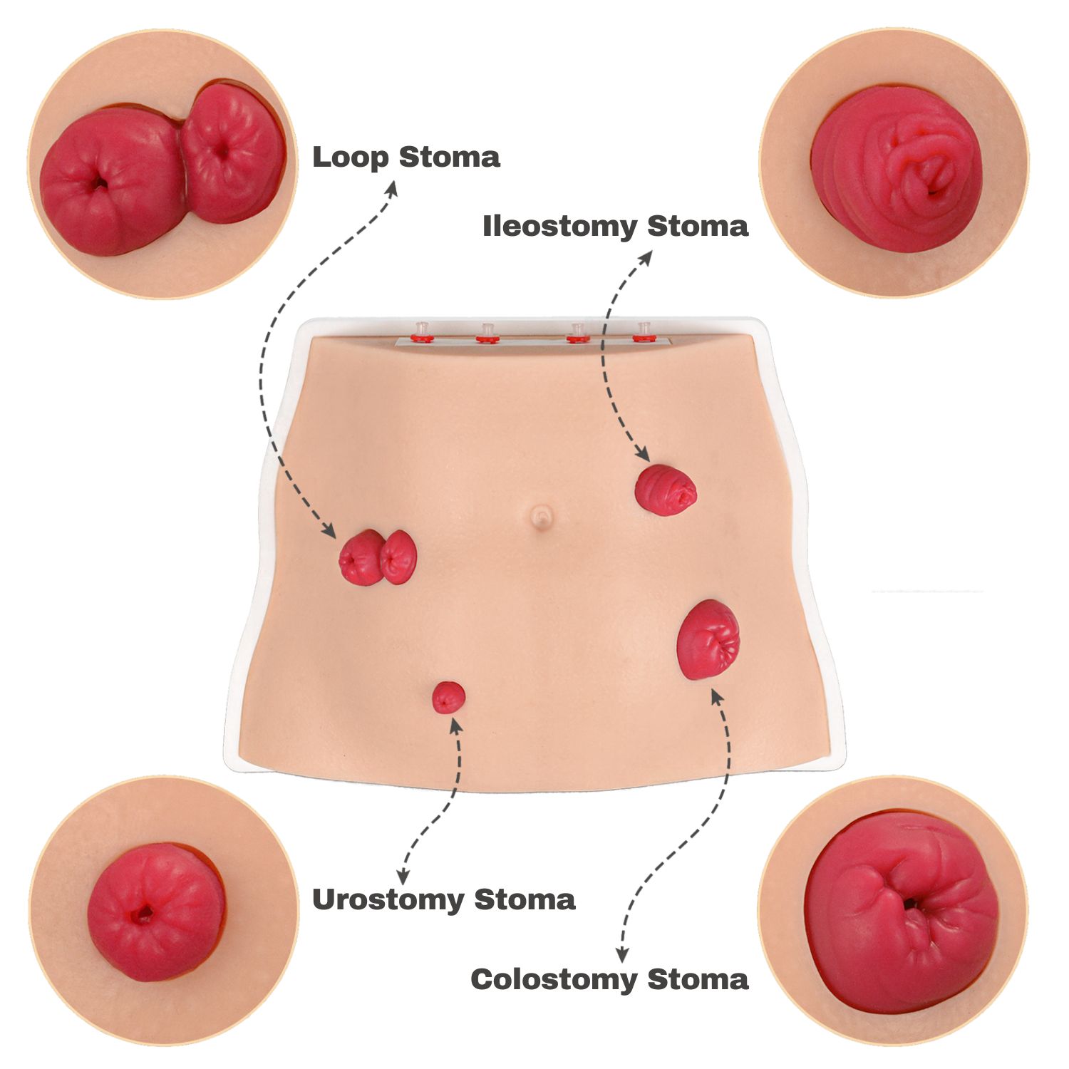 Tabletop Ostomy Care Simulator with 4 Stoma Types
