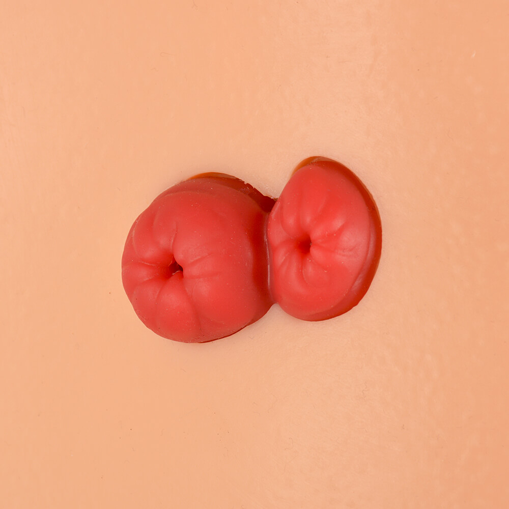 Ostomy Care Simulator with 4 Stoma Types & Display Bracket