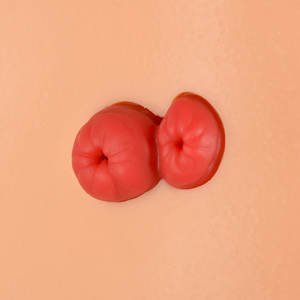 Ostomy Care Simulator with 4 Stoma Types & Display Bracket