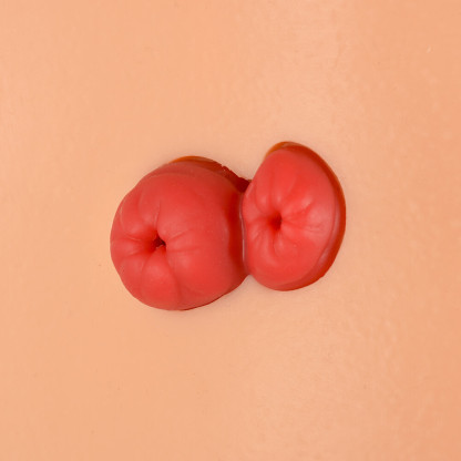 Ostomy Care Simulator with 4 Stoma Types & Display Bracket