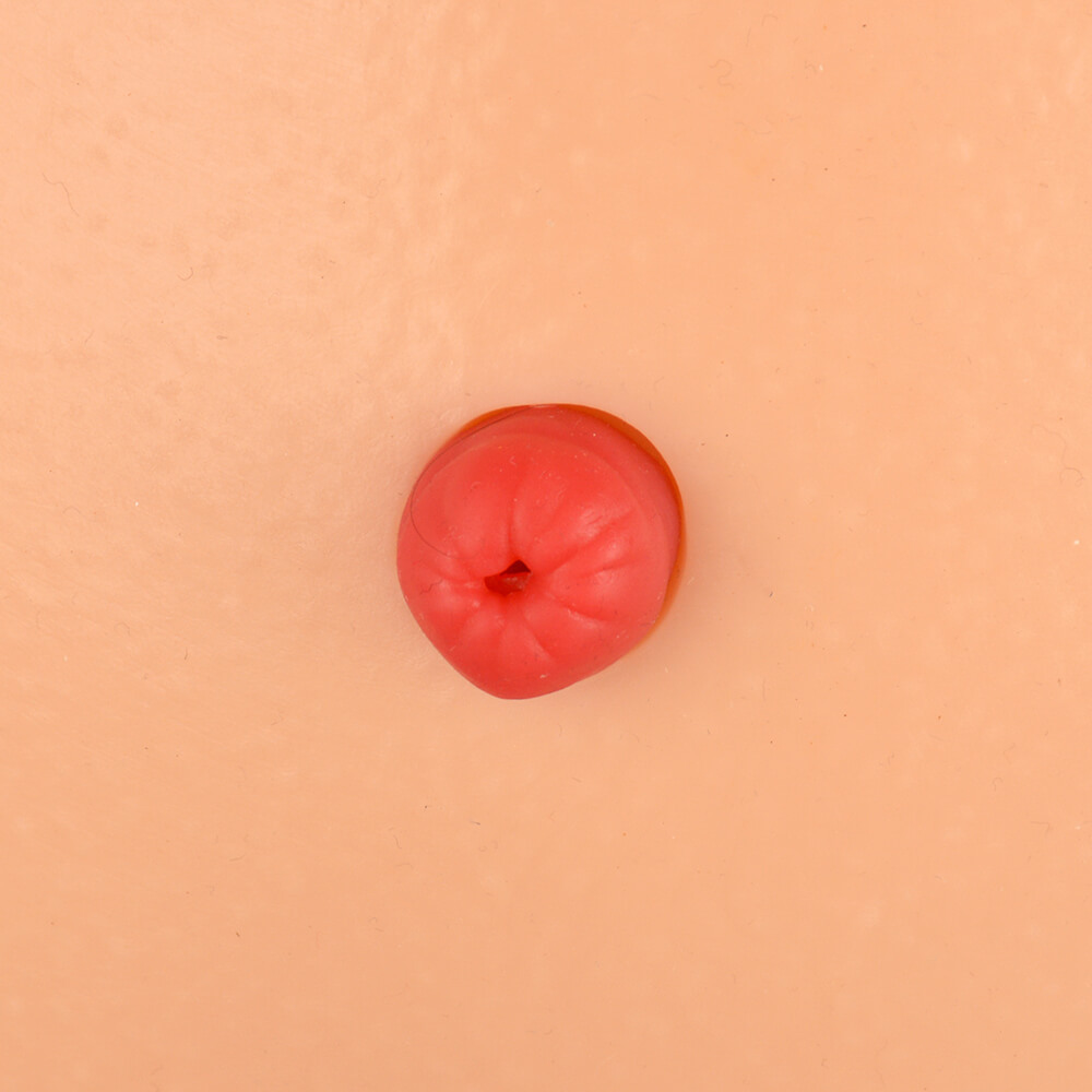 Ostomy Care Simulator with 4 Stoma Types & Display Bracket