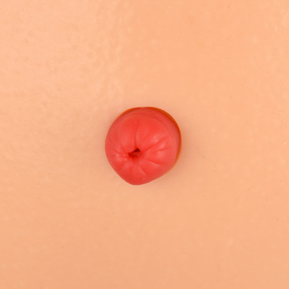 Ostomy Care Simulator with 4 Stoma Types & Display Bracket