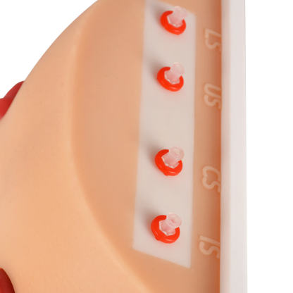 Ostomy Care Simulator with 4 Stoma Types & Display Bracket