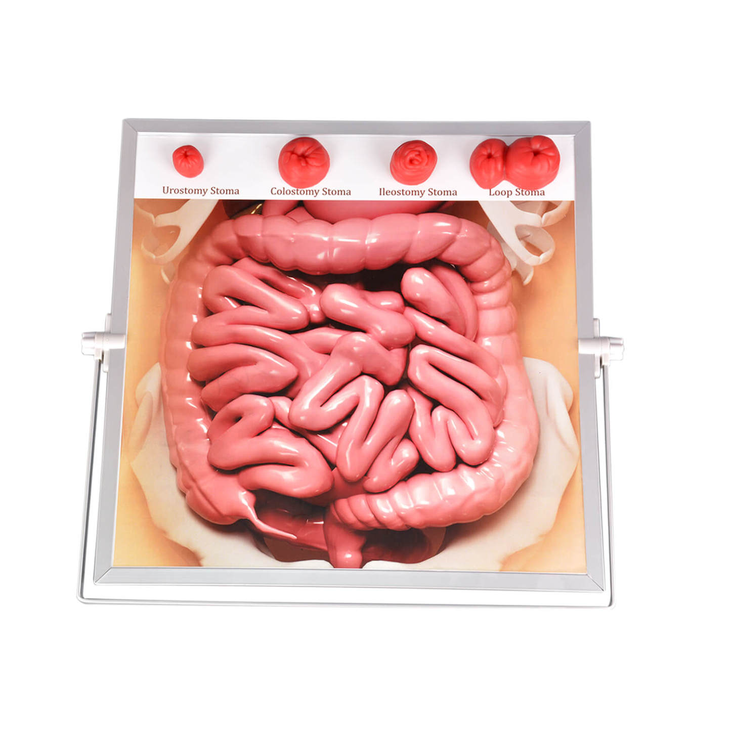 Ostomy Care Teaching Models Kit, Tabletop & Hangable