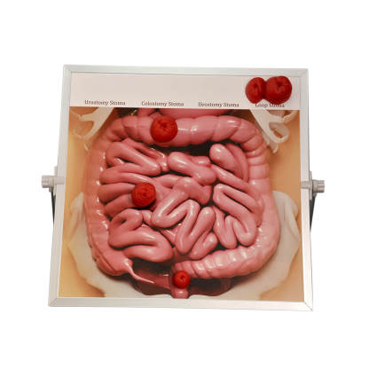 Ostomy Care Teaching Models Kit, Tabletop & Hangable