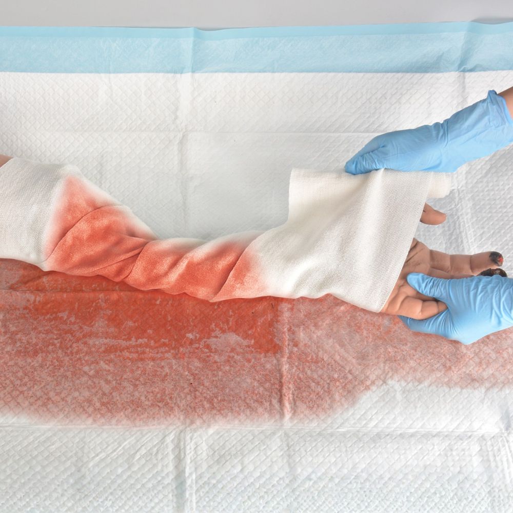 Partial Arm Amputation Wound Simulator, Left