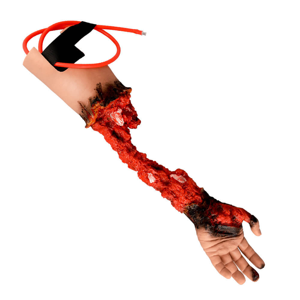 Partial Arm Amputation Wound Simulator, Left