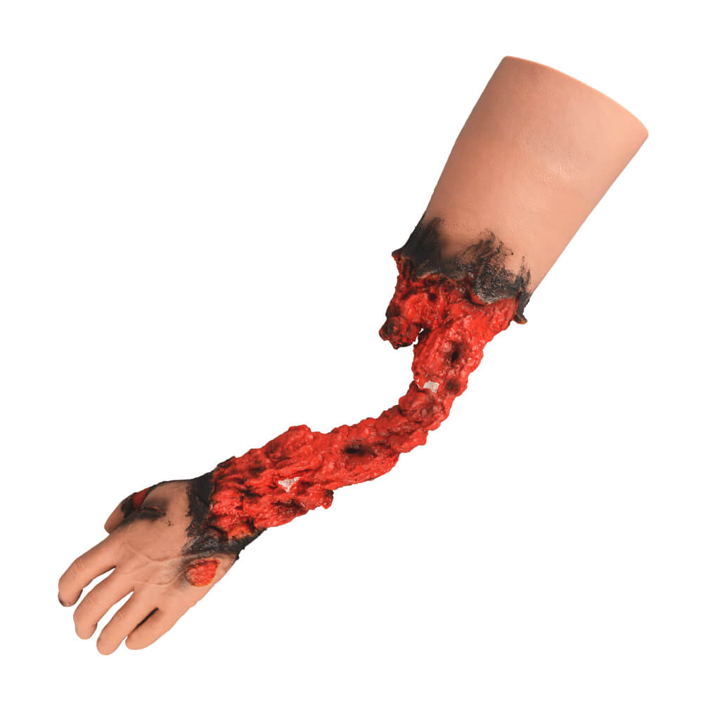 Partial Arm Amputation Wound Simulator, Left