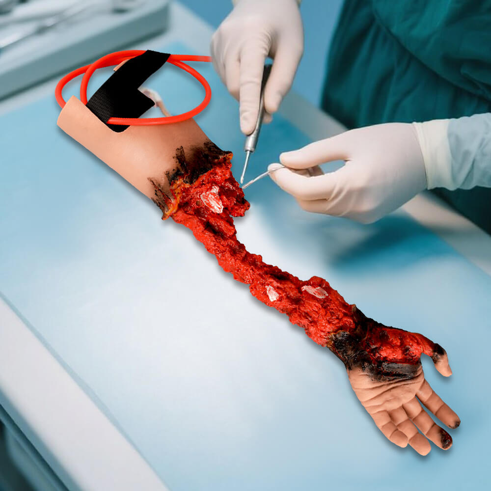 Partial Arm Amputation Wound Simulator, Left