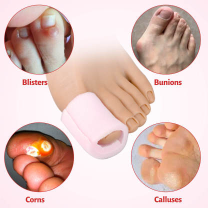 Ultrassist Toe Sleeve Protectors for Blisters, Bunions, Corns Relief