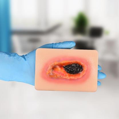 Pocket-Sized Necrotic Wound Simulation Model Set