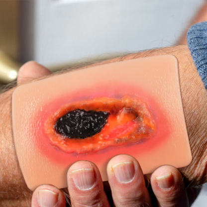 Pocket-Sized Necrotic Wound Simulation Model Set