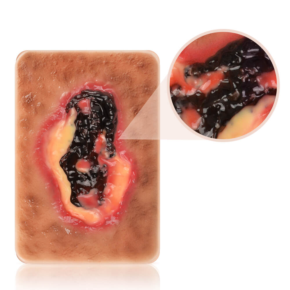 Pocket-Sized Necrotic Wound Simulation Model Set