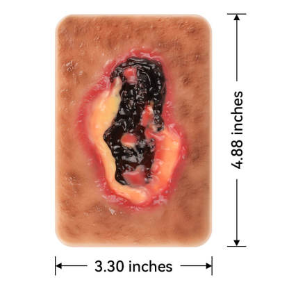 Pocket-Sized Necrotic Wound Simulation Model Set