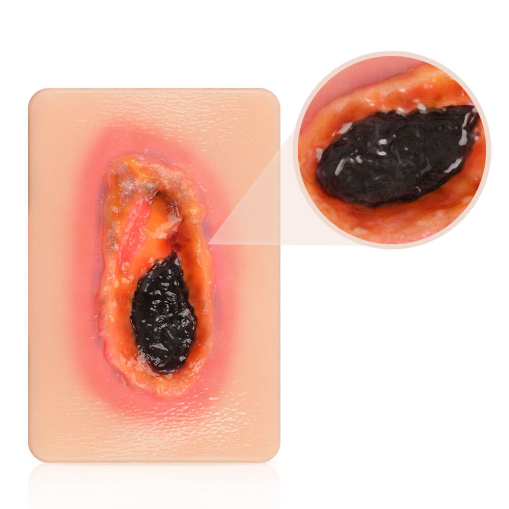 Pocket-Sized Necrotic Wound Simulation Model Set