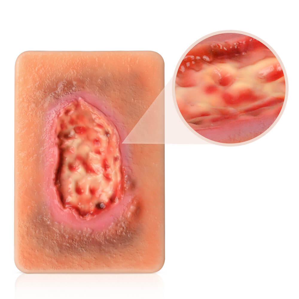 Pocket-Sized Necrotic Wound Simulation Model Set