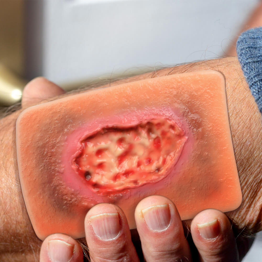 Pocket-Sized Necrotic Wound Simulation Model Set