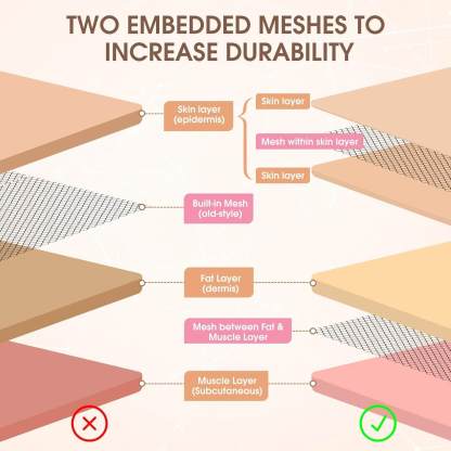 Ultrassist Silicone Suture Practice Pad | DIY Training for Medical Students