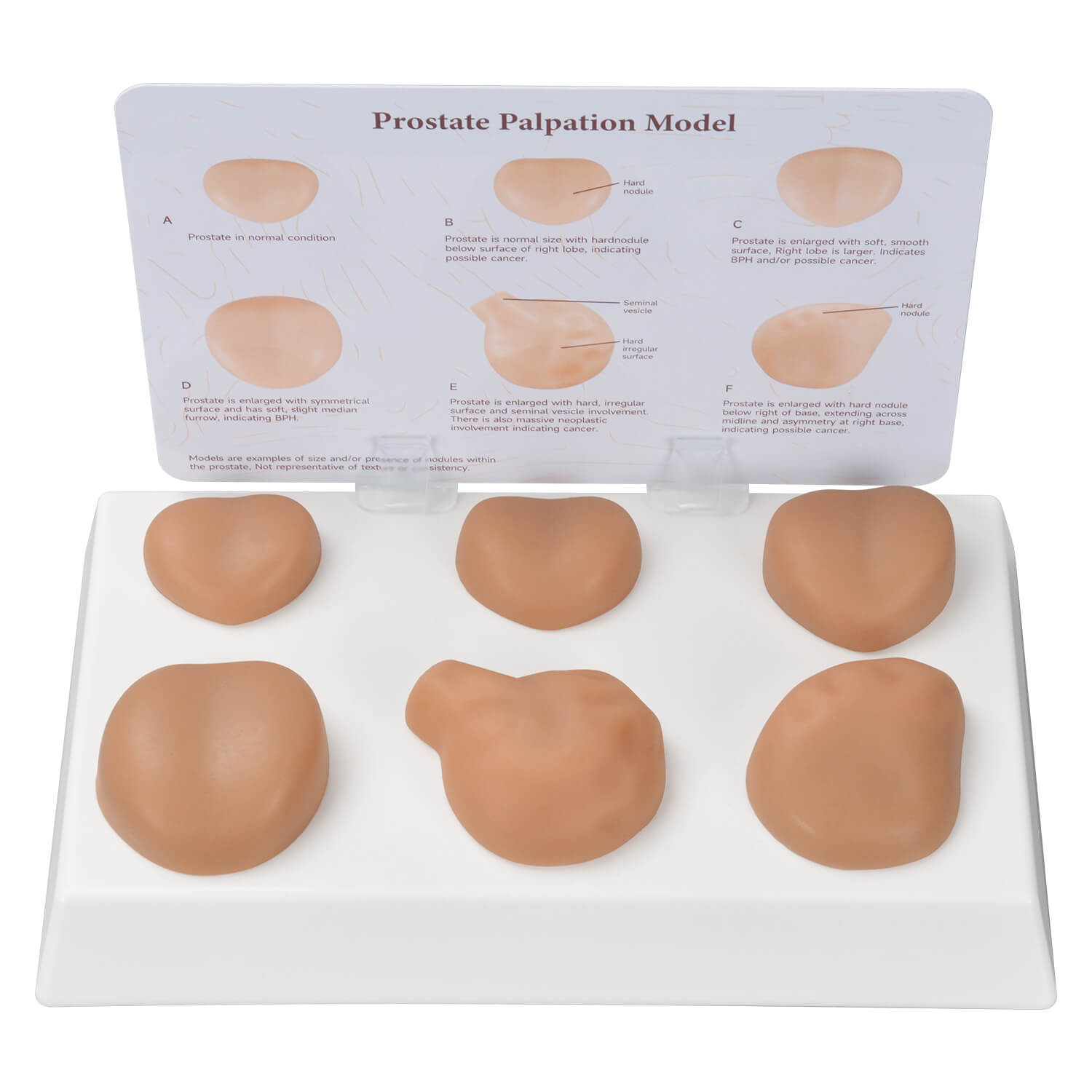 Prostate Examination Training Model with Normal & 5 Pathological Variants