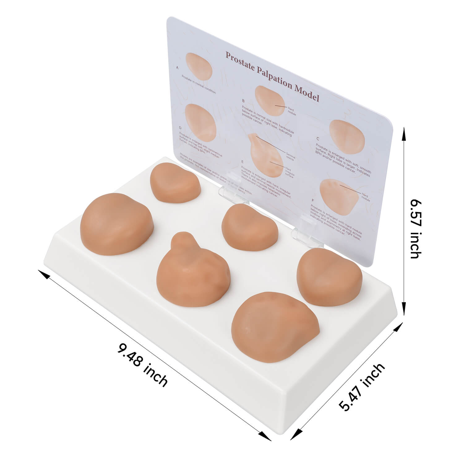 Prostate Examination Training Model with Normal & 5 Pathological Variants