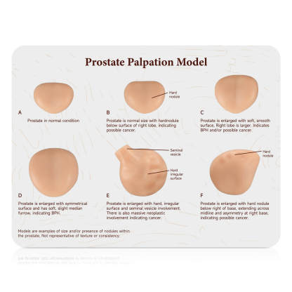 Prostate Examination Training Model Set