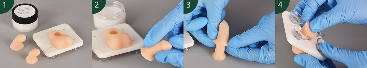 Steps to Replace Foreskin for Infant Circumcision Trainer
