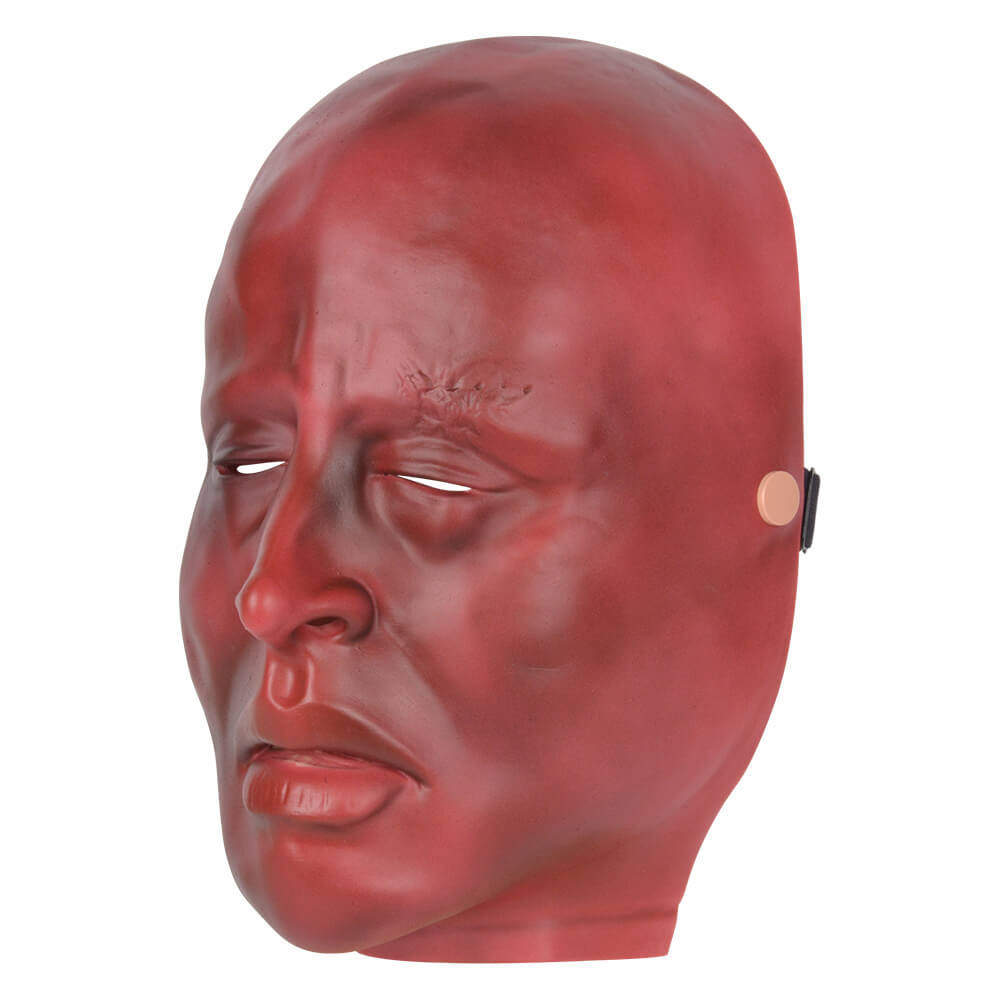 Severe Burn Face Model